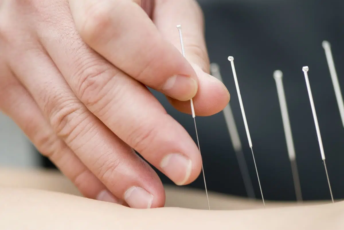 acupuncteur in Vancouver