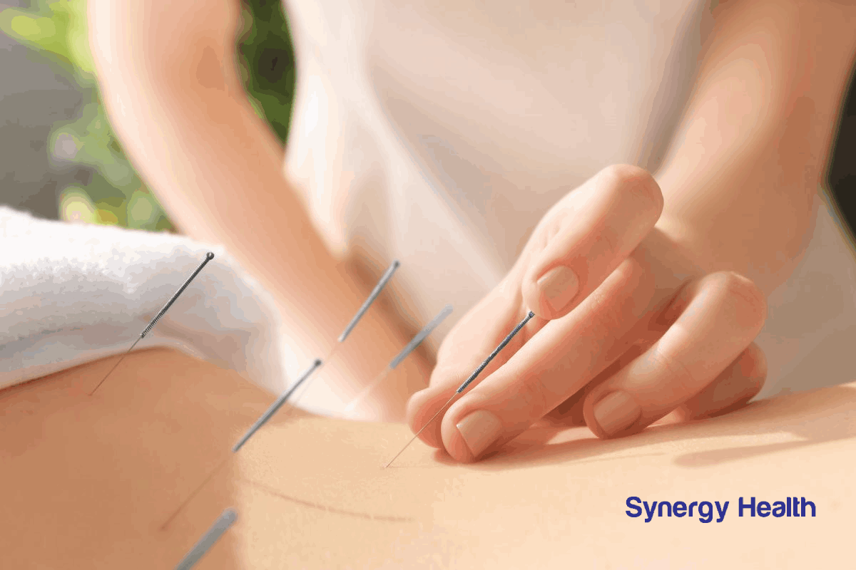 Acupuncture for Treat Back Pain