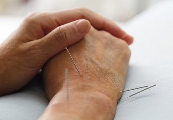 How Acupuncture Can Help with Anxiety